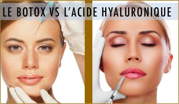 acide hyaluronique et botox acide hyaluronique et botox